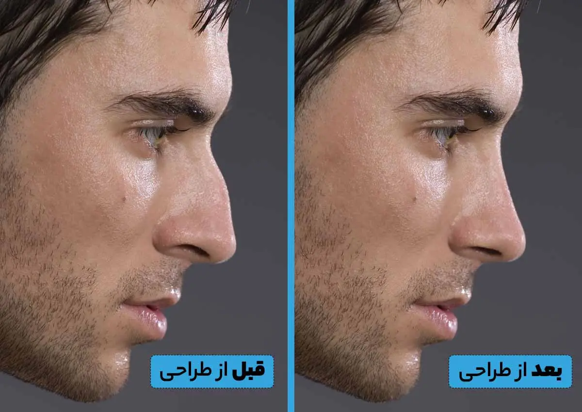 طراحی بینی با هوش مصنوعی پزشک 24