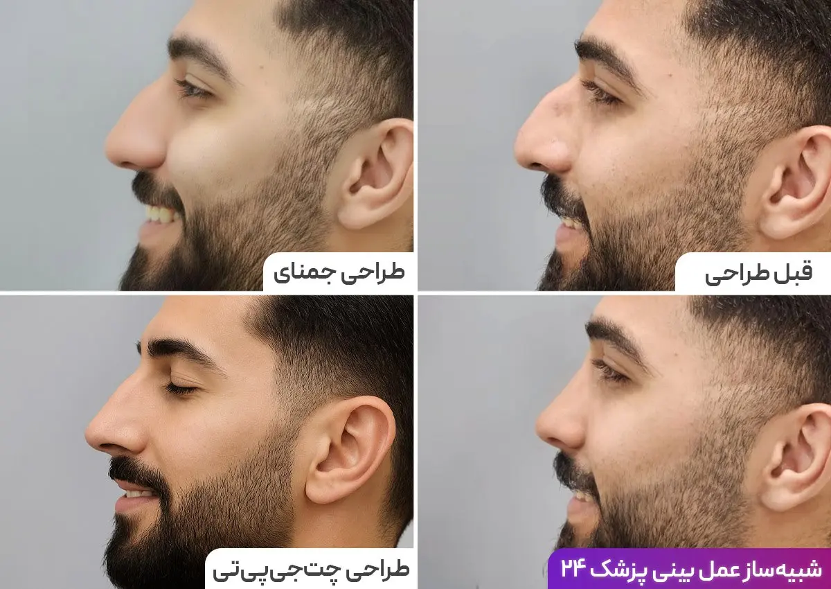 تفاوت طراحی بینی با رینوبات و سایر ابزارهای هوش مصنوعی