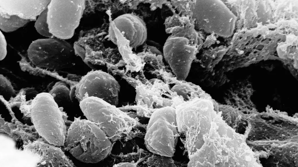 black-death-plague-bacteria-1-840489