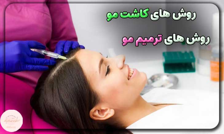 مقایسه روش های کاشت مو و ترمیم مو