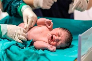 لحظه به دنیا آمدن نوزاد با کیسه  آمنیوتیک/ ویدئو