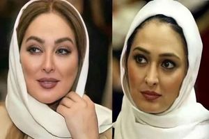 تغییرات ظاهری بازیگران خانم از گذشته تا الان/ ویدئو