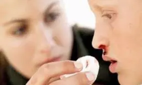 خونریزی هایی که نشانه هموفیلی هستند