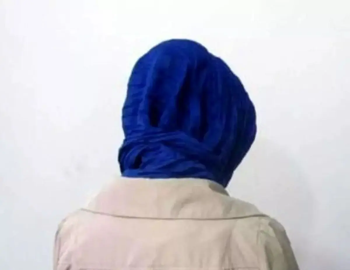  یک آرایشگاه زیبایی چگونه صورت یک زن را از ریخت انداخت؟/ عکس

