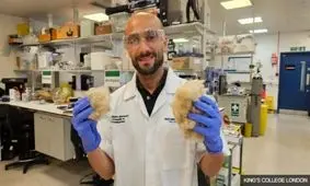 ترمیم دندان با خمیردندان ساخته شده از مو