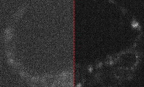 دوربین‌های کوانتومی اولین لحظات شکل‌گیری جنین را ثبت کردند

