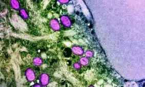 سازمان جهانی بهداشت اولین آزمایش تشخیصی «آبله میمونی» را تایید کرد