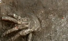 راز دست‌هایی که ۳۵۰۰ سال پیش قطع شدند