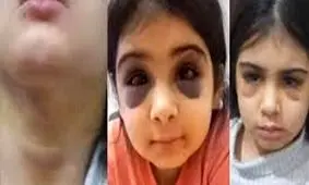 ماجرای کودک آزاری «آنیلا» در سنندج