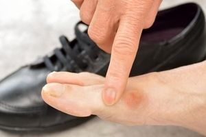 کفش نامناسب عامل چه بیماری هایی است؟