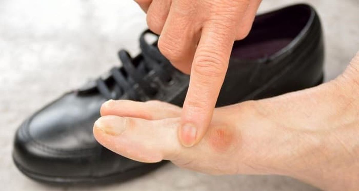 کفش نامناسب عامل چه بیماری هایی است؟