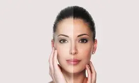 این ۵ خوراکی‌ اثر کرم‌ های صورت را از بین می برند