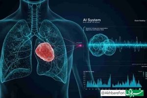 هوش مصنوعی که تومورهای پنهان ریه را حتی بهتر از پزشکان شناسایی می‌کند