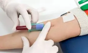 خانم ​ها اگر این نشانه​ ها را دارید آزمایش خون بدهید