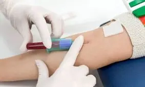 خانم ​ها اگر این نشانه​ ها را دارید آزمایش خون بدهید