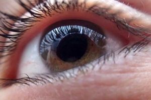 روش تشخیص یک عارضه چشمی که علائم اولیه ندارد