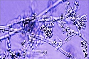 بانداژهای ساخته شده از قارچهای زنده؛ آینده التیام زخم