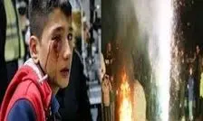 چهارشنبه‌سوری نیامده ۳ مصدوم گرفت