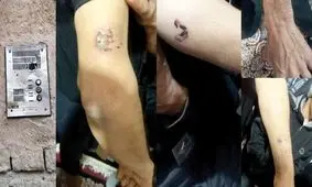 ارث پدری این پسر را وحشی کرد/ همه را گاز گرفت و پدرش را کشت 