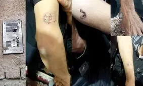 ارث پدری این پسر را وحشی کرد/ همه را گاز گرفت و پدرش را کشت 