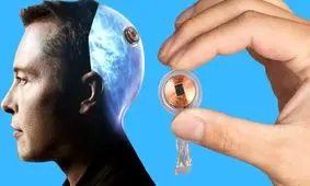 درخواست هزاران پزشک علیه تصمیم «ایلان ماسک»/ به تراشه مغزی «نورالینک» مجوز ندهید