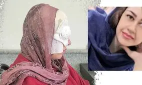 اسیدپاشی عاشق کینه جو به زن جوان و دختر بی گناهش 