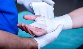 افزایش ورود شرکت‌های دانش‌بنیان به حوزه تولید پانسمان‌های سوختگی

