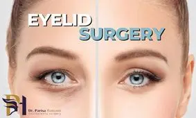 بهترین جراح پلک تهران کیست؟