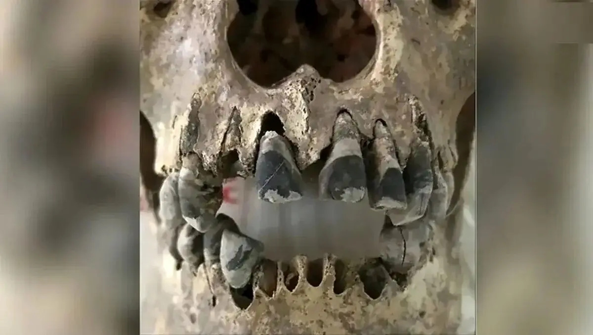 راز جمجمه‌ های ۲ هزارساله با «دندان‌ های سیاه» چیست؟
