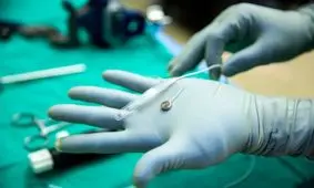 رقیب نورالینک، ایمپلنت مغزی خود را با موفقیت روی یک بیمار آزمایش کرد

