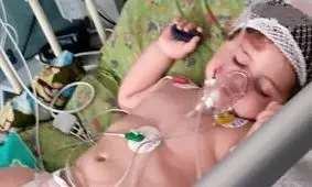 کودک سه‌ساله قربانی حمله سگ وحشی در بهشهر / کودک در بیمارستان بستری شد