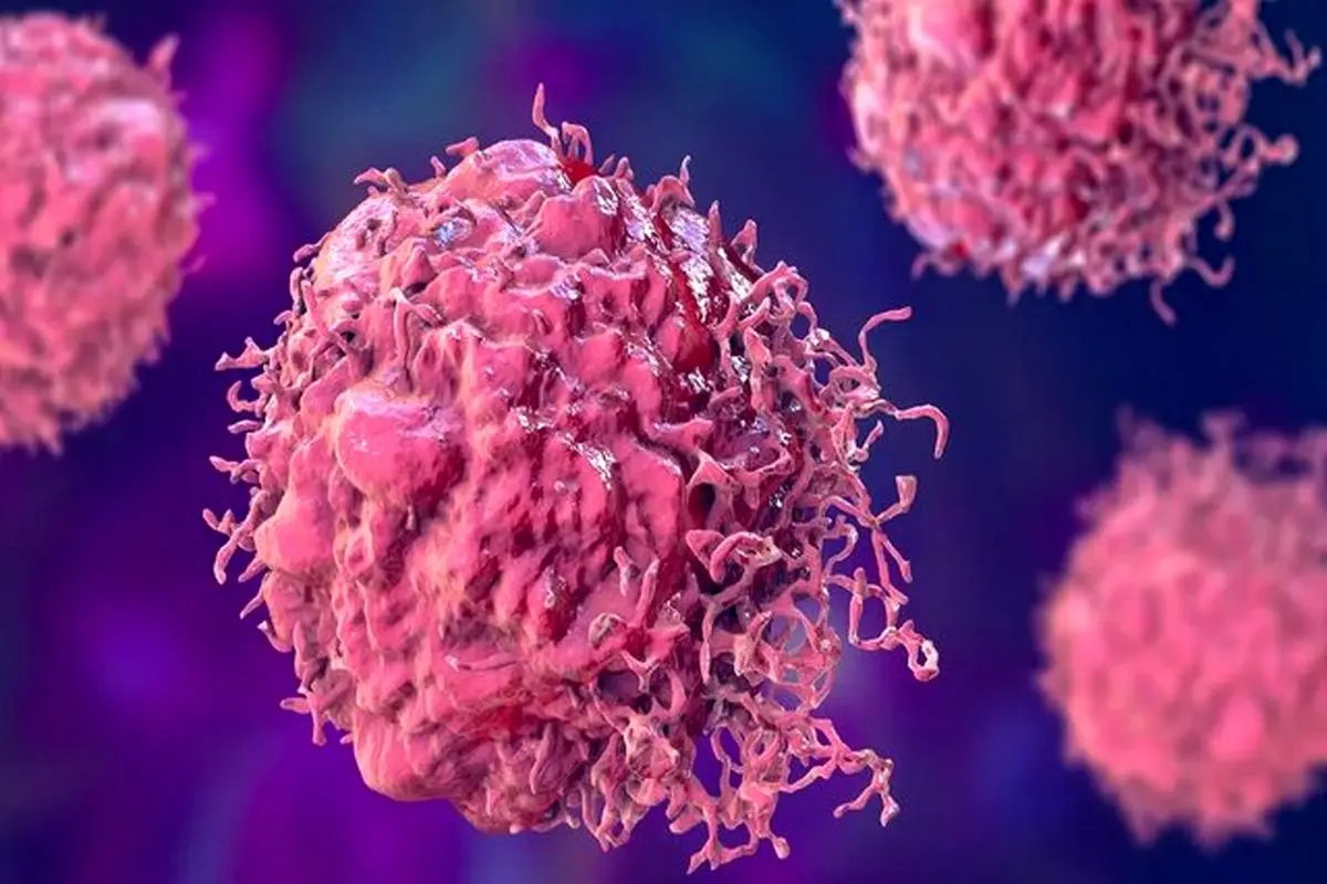 احتمال ۲۰ درصدی ابتلا به سرطان برای هر فرد