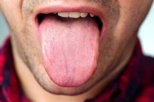 رنگ زبان نشان دهنده چه بیماری هایی است؟