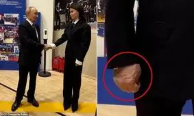 آیا پوتین بیمار است یا فقط پیر شده؟