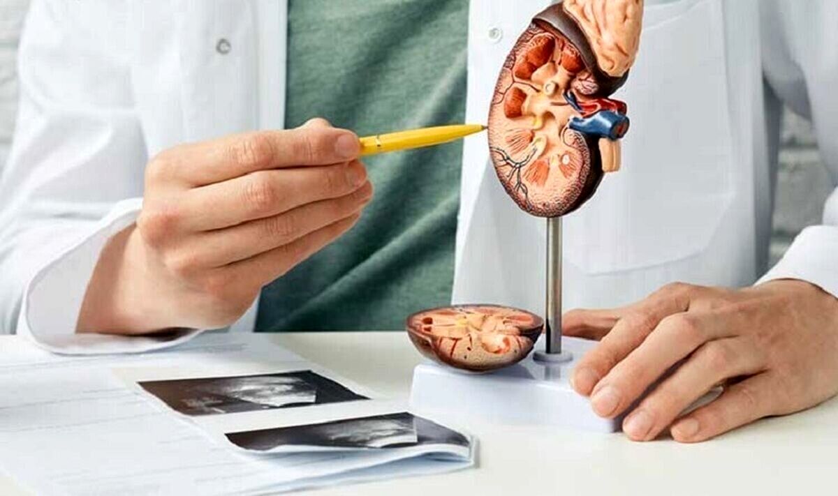 چرا سنگ کلیه میگیریم؟