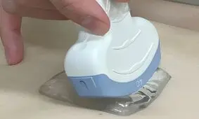 تجربه خوشایندتر سونوگرافی با یک پد ژل نوآورانه

