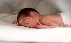 هشدار وزارت بهداشت درباره سزارین ها در «۰۲.۰۲.۰۲»