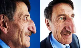 بلندترین بینی در جهان متعلق به کیست؟/ ویدئو