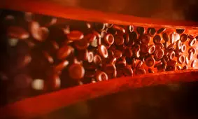 علائمی که نشان می‌دهد یک لخته خون «کشنده» درون خود دارید