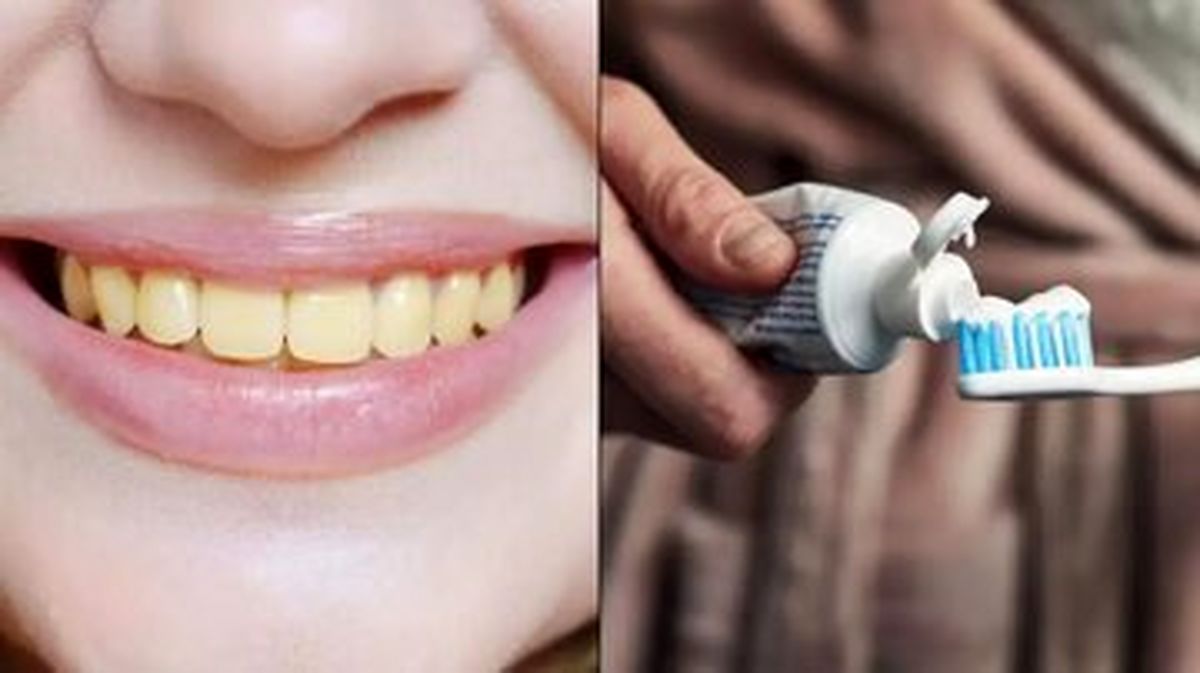 چرا دندان ها زشت میشوند؟