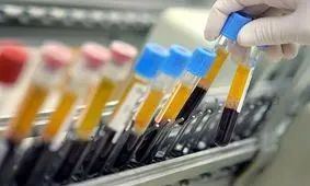 محرومیت یک وزنه‌بردار و یک جودوکار به دلیل دوپینگ

