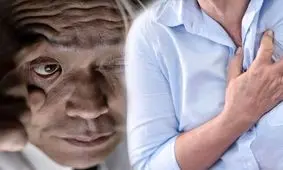 ۳ نشانه کلیدی کلسترول بالا که در چشم ظاهر می‌شود و نباید نادیده بگیرید