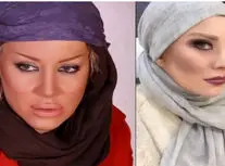 شراره رخام: تزریق ژل لب بازیگری منو نابود کرد/ ویدئو