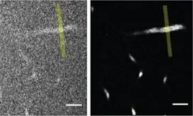 ثبت تصاویر دقیق از مغز با یک میکروسکوپ قوی