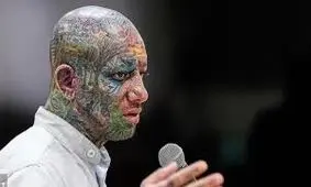 سکته مغزی تتلو صحت دارد؟ 