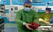 تومور ۳.۵ کیلویی از کلیه یک بیمار ۵۱ ساله در تربت حیدریه خارج شد

