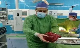 تومور ۳.۵ کیلویی از کلیه یک بیمار ۵۱ ساله در تربت حیدریه خارج شد

