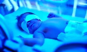 بی‌توجهی به زردی نوزاد می‌تواند سبب ناشنوایی یا عقب ماندگی ذهنی شود