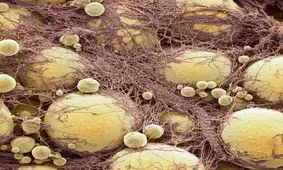 سلول‌های چربی خاطره‌ چاقی را به یاد می‌آورند!

