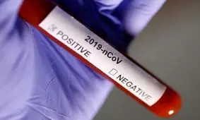 عوارض ابتلای مجدد به کرونا خطرناک تر است